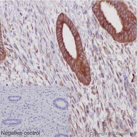 Immunohistochemistry (Formalin/PFA-fixed paraffin-embedded sections) - Anti-ERp72 [EPR14825] antibody (ab190354)