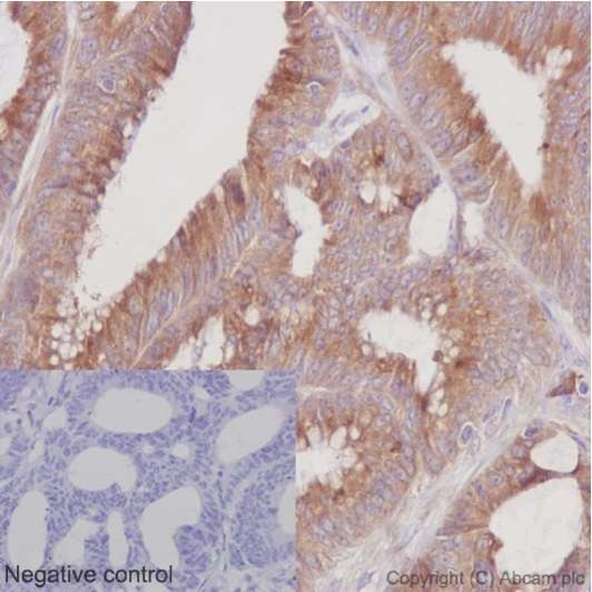 Immunohistochemistry (Formalin/PFA-fixed paraffin-embedded sections) - Anti-ERp72 [EPR14825] antibody (ab190354)