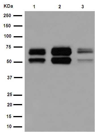 Western blot - Anti-Ikaros [EPR13791] antibody - C-terminal (ab190691)