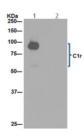 Immunoprecipitation - Anti-C1r [EPR14914] antibody - N-terminal (ab190800)