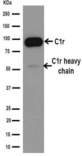 Western blot - Anti-C1r [EPR14914] antibody - N-terminal (ab190800)