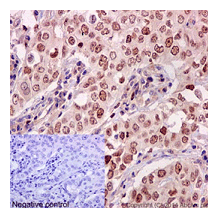 Immunohistochemistry (Formalin/PFA-fixed paraffin-embedded sections) - Anti-KMT6 / EZH2 [EPR9307(2)] antibody - N-terminal (ab191080)