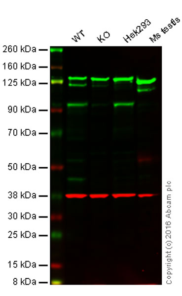 Western blot - Anti-KMT6 / EZH2 [EPR9307(2)] antibody - N-terminal (ab191080)