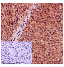 Immunohistochemistry (Formalin/PFA-fixed paraffin-embedded sections) - Anti-CRM1 [O14980] antibody - C-terminal (ab191081)