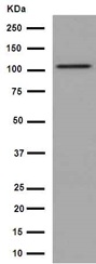 Western blot - Anti-DPP6 antibody [EPR15944] (ab191421)