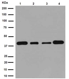 Western blot - Anti-EIF3S4 antibody [EPR16146] (ab191422)