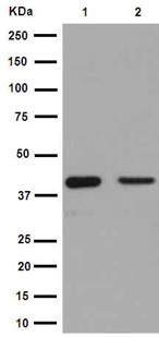 Western blot - Anti-EIF3S4 antibody [EPR16146] (ab191422)