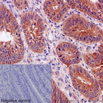 Immunohistochemistry (Formalin/PFA-fixed paraffin-embedded sections) - Anti-EIF3S4 antibody [EPR16146] (ab191422)