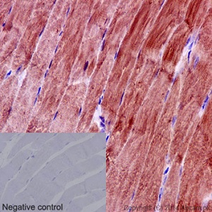 Immunohistochemistry (Formalin/PFA-fixed paraffin-embedded sections) - Anti-EIF3S4 antibody [EPR16146] (ab191422)