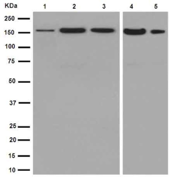 Western blot - Anti-ADCY9 [EPR16188] antibody (ab191423)