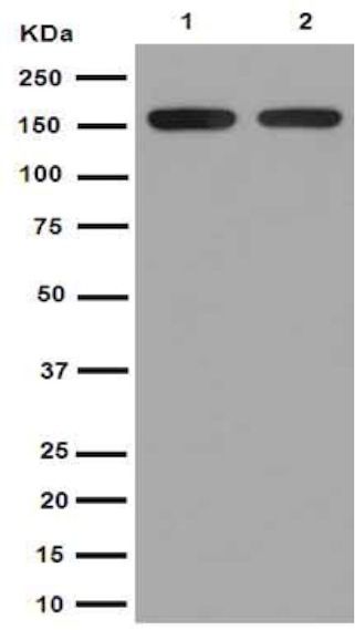 Western blot - Anti-ADCY9 [EPR16188] antibody (ab191423)
