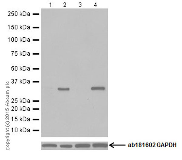 Western blot - Anti-DDIT4 antibody [EPR18716] (ab191871)