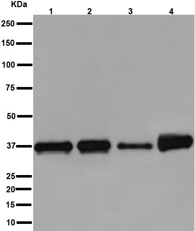 Western blot - Anti-ARA9 [EPR13585] antibody (ab192024)