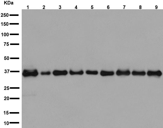 Western blot - Anti-ARA9 [EPR13585] antibody (ab192024)