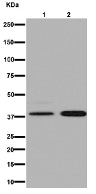 Western blot - Anti-C20orf7 antibody [EPR15870] (ab192235)
