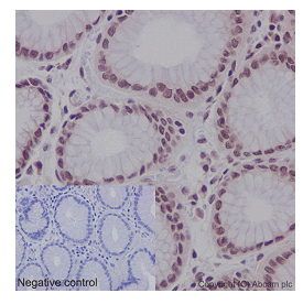 Immunohistochemistry (Formalin/PFA-fixed paraffin-embedded sections) - Anti-CDCA5 antibody [EPR16331] - C-terminal (ab192237)