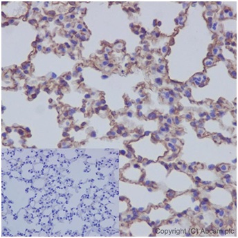 Immunohistochemistry (Formalin/PFA-fixed paraffin-embedded sections) - Anti-Caveolin-1 antibody [EPR15554] (ab192869)