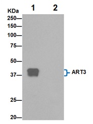 Immunoprecipitation - Anti-ART3 antibody [EPR7220(2)] (ab192870)