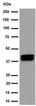 Western blot - Anti-ART3 antibody [EPR7220(2)] (ab192870)