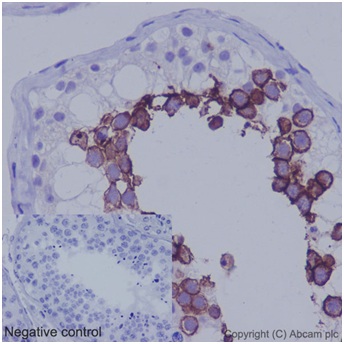 Immunohistochemistry (Formalin/PFA-fixed paraffin-embedded sections) - Anti-ART3 antibody [EPR7220(2)] (ab192870)