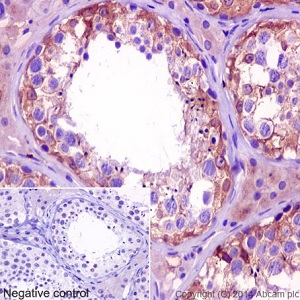 Immunohistochemistry (Formalin/PFA-fixed paraffin-embedded sections) - Anti-Kinesin 5C antibody [EPR16224-32] (ab193352)