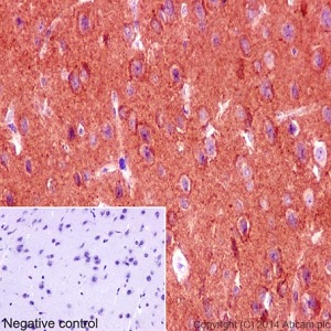 Immunohistochemistry (Formalin/PFA-fixed paraffin-embedded sections) - Anti-Kinesin 5C antibody [EPR16224-32] (ab193352)