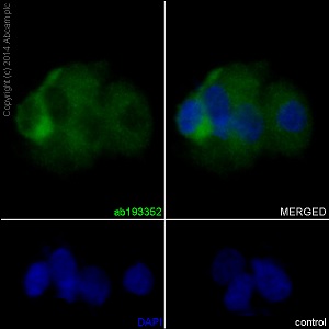 Immunocytochemistry/ Immunofluorescence - Anti-Kinesin 5C antibody [EPR16224-32] (ab193352)