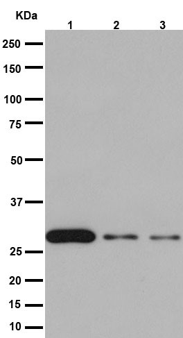 Western blot - Anti-14-3-3 sigma antibody [EPR5873(2)] (ab193667)