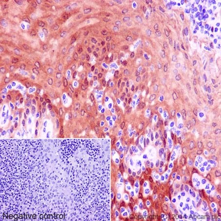 Immunohistochemistry (Formalin/PFA-fixed paraffin-embedded sections) - Anti-14-3-3 sigma antibody [EPR5873(2)] (ab193667)