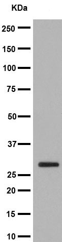 Western blot - Anti-14-3-3 sigma antibody [EPR5873(2)] (ab193667)