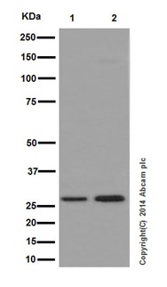 Western blot - Anti-KCTD5 antibody [EPR16312] (ab194825)