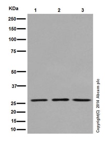 Western blot - Anti-KCTD5 antibody [EPR16312] (ab194825)