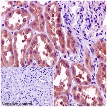 Immunohistochemistry (Formalin/PFA-fixed paraffin-embedded sections) - Anti-KCTD5 antibody [EPR16312] (ab194825)