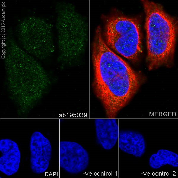 Immunocytochemistry/ Immunofluorescence - Anti-PKC beta 1 antibody [EPR18512] (ab195039)