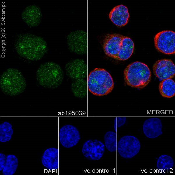 Immunocytochemistry/ Immunofluorescence - Anti-PKC beta 1 antibody [EPR18512] (ab195039)
