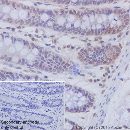 Immunohistochemistry (Formalin/PFA-fixed paraffin-embedded sections) - Anti-PKC beta 1 antibody [EPR18512] (ab195039)