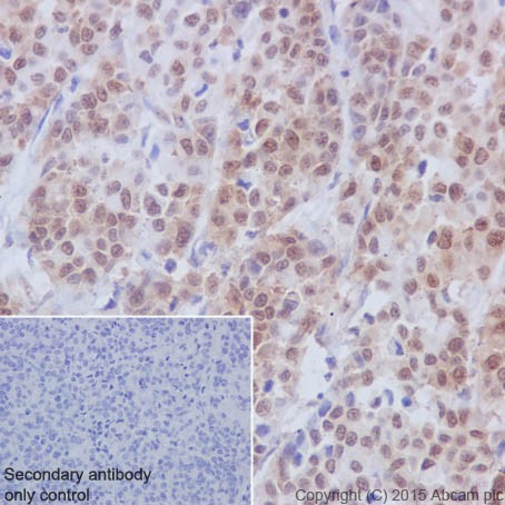 Immunohistochemistry (Formalin/PFA-fixed paraffin-embedded sections) - Anti-PKC beta 1 antibody [EPR18512] (ab195039)