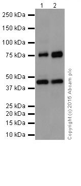 Western blot - Anti-PKC beta 1 antibody [EPR18512] (ab195039)