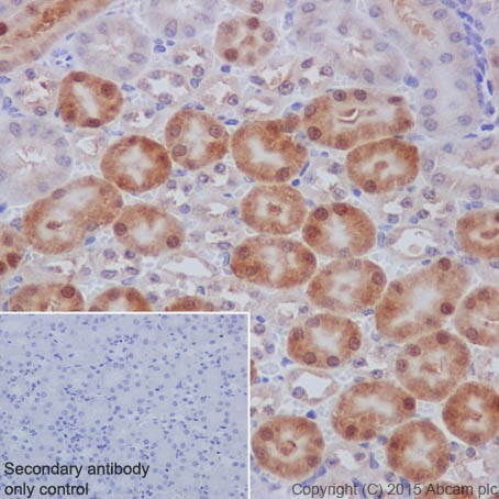 Immunohistochemistry (Formalin/PFA-fixed paraffin-embedded sections) - Anti-PKC beta 1 antibody [EPR18512] (ab195039)