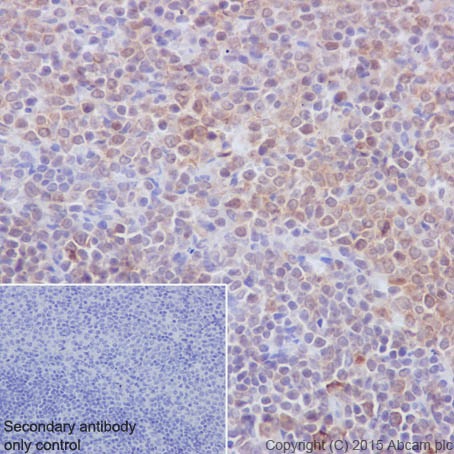 Immunohistochemistry (Formalin/PFA-fixed paraffin-embedded sections) - Anti-PKC beta 1 antibody [EPR18512] (ab195039)