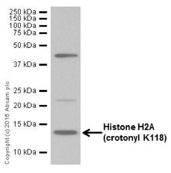 Western blot - Anti-Histone H2A (croto<i></i>nyl K118) antibody [EP18768] (ab195466)