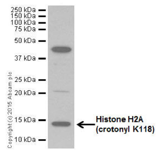 Western blot - Anti-Histone H2A (croto<i></i>nyl K118) antibody [EP18768] (ab195466)