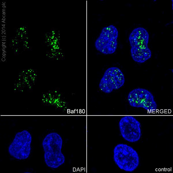 Immunocytochemistry/ Immunofluorescence - Anti-Baf180 antibody [EPR15860] (ab196022)