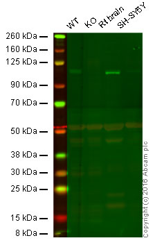 Western blot - Anti-Baf180 antibody [EPR15860] (ab196022)