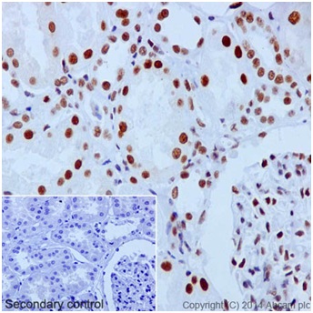 Immunohistochemistry (Formalin/PFA-fixed paraffin-embedded sections) - Anti-Baf180 antibody [EPR15860] (ab196022)