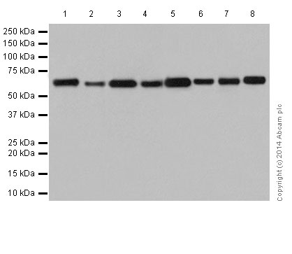 Western blot - Anti-2 Hydroxy phytanoyl CoA lyase  antibody [EPR16812] (ab197025)