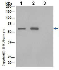 Immunoprecipitation - Anti-2 Hydroxy phytanoyl CoA lyase  antibody [EPR16812] (ab197025)