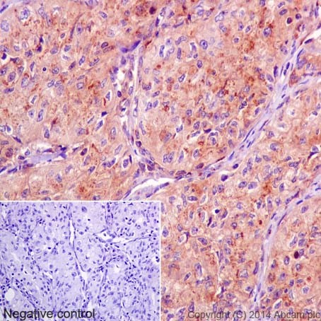 Immunohistochemistry (Formalin/PFA-fixed paraffin-embedded sections) - Anti-GOLPH4 antibody [EPR13439] (ab197595)