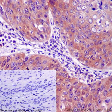 Immunohistochemistry (Formalin/PFA-fixed paraffin-embedded sections) - Anti-PPP2R5E antibody [EPR17147] (ab198500)