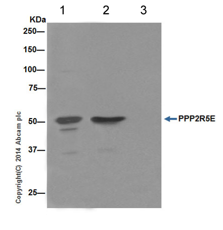 Immunoprecipitation - Anti-PPP2R5E antibody [EPR17147] (ab198500)